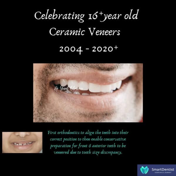 Dental Treatment Albany