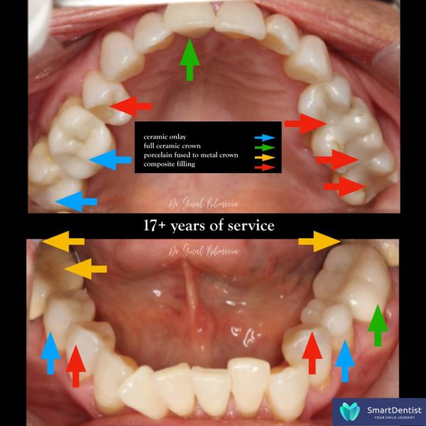 Dental Treatment Albany