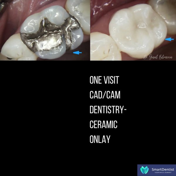 Dental Treatment Albany