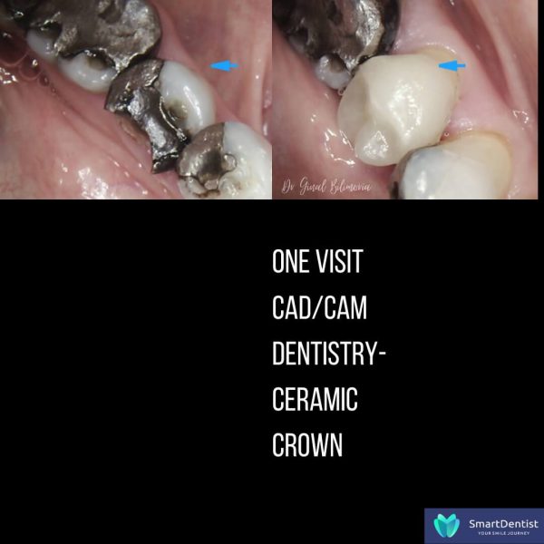 Dental Treatment Albany