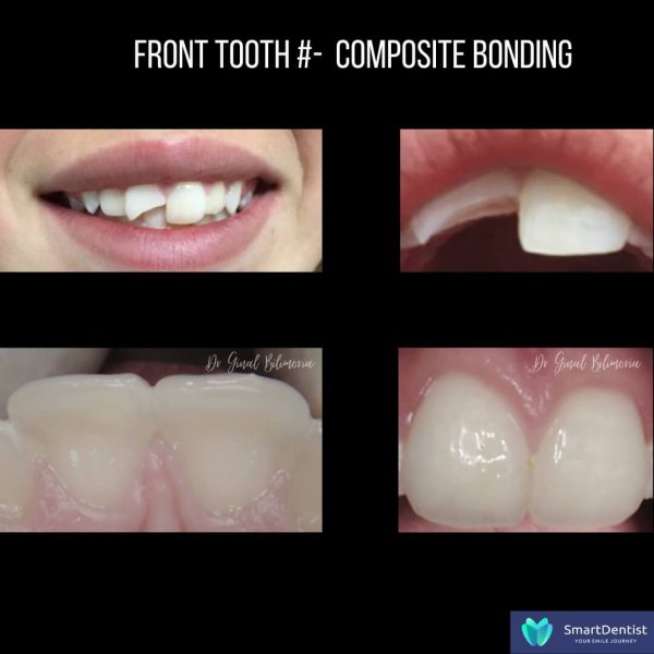 Dental Treatment Albany