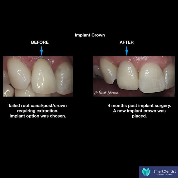 Dental Treatment Albany