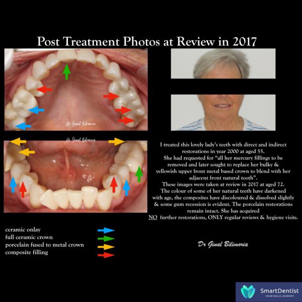Dental Treatment Albany