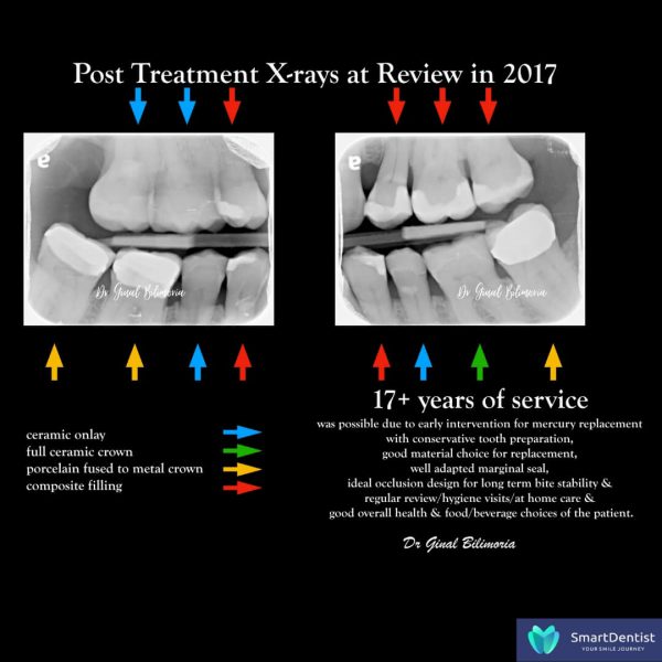 Dental Treatment Albany