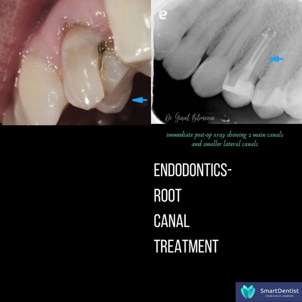 Dental Treatment Albany