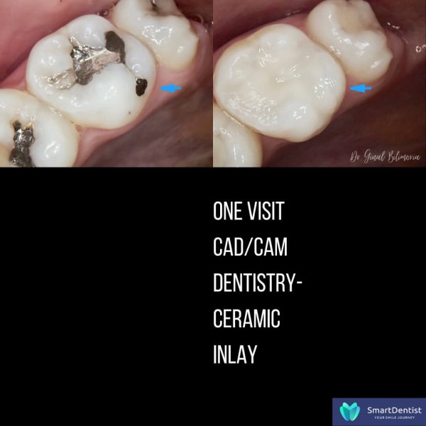 Dental Treatment Albany