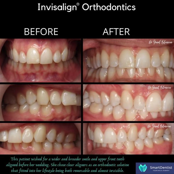Dental Treatment Albany
