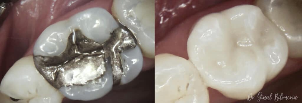 Cerec Dentistry Albany